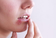 Herpes Kulit, Ternyata Bisa Menular Lewat Udara