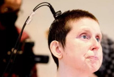 AI Membantu Perempuan Kena Stroke Kembali Bicara Setelah 18 Tahun