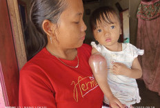 Boca Mengidap Kangker Warga Desa Talang Tinggi Ulu Manna Butuh Bantuan Dana Untuk Oprasi