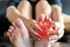 Cara Efektif, Redakan Asam Urat di Kaki