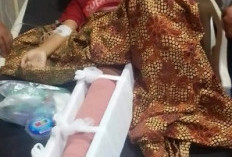 Malang Nasib Remaja Lubuk Gio, Kaki Diamputasi Akibat Laka